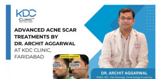 Advanced Acne Scar Treatments by Dr. Archit Aggarwal at KDC Clinic, Faridabad