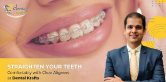 Straighten Your Teeth Comfortably with Clear Aligners at Dental Krafts
