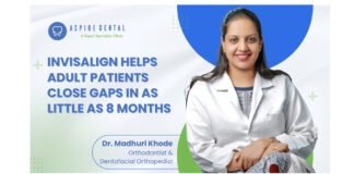 Invisalign Treatment Delivers Predictable Results for Adult Patients, Achieving Complete Space Closure in as Little as 8 Months