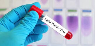 Why Regular Lipid Profile Tests Are Crucial for Heart Health